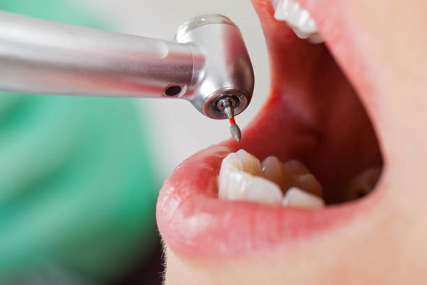 Best Emergency Dental Extractions in Lone Pine, CA